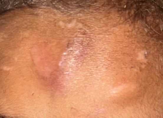 Barra: Casal é preso por suspeita de torturar filha adotiva de 7 anos com palmatória, cordas e cipós