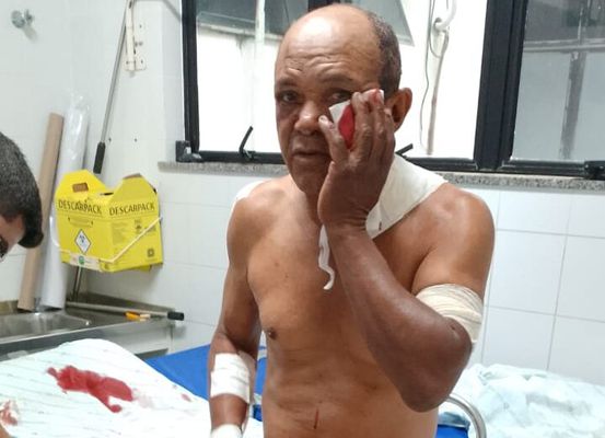 Homem é baleado com vários tiros no povoado de Meia Hora