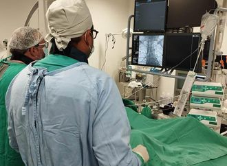 Hospital Regional de Irecê oferece exame inédito para diagnóstico de doenças vasculares do cérebro