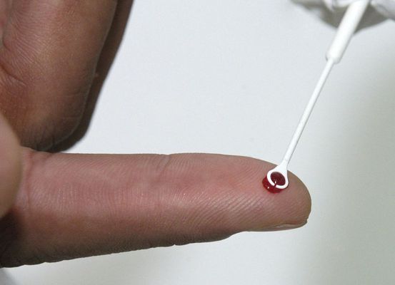 Saúde amplia vacinação contra o HPV para quem usa PrEP